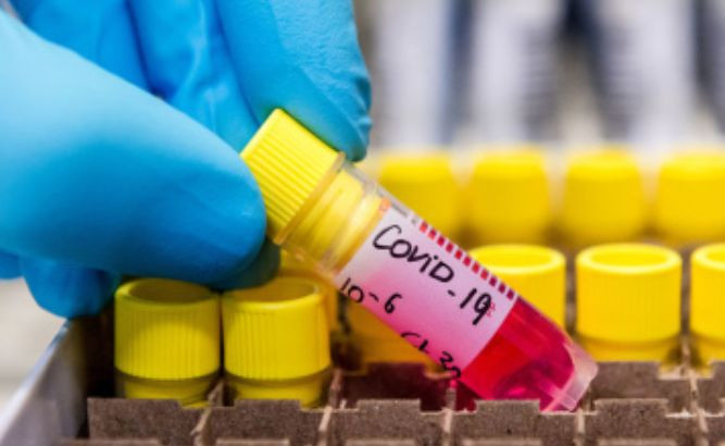 Смертність від коронавірусу: яка вікова категорія найуразливіша, інфографіка