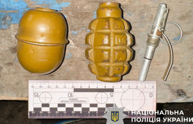 На Київщині в руках у дитини вибухнув запал від гранати, фото