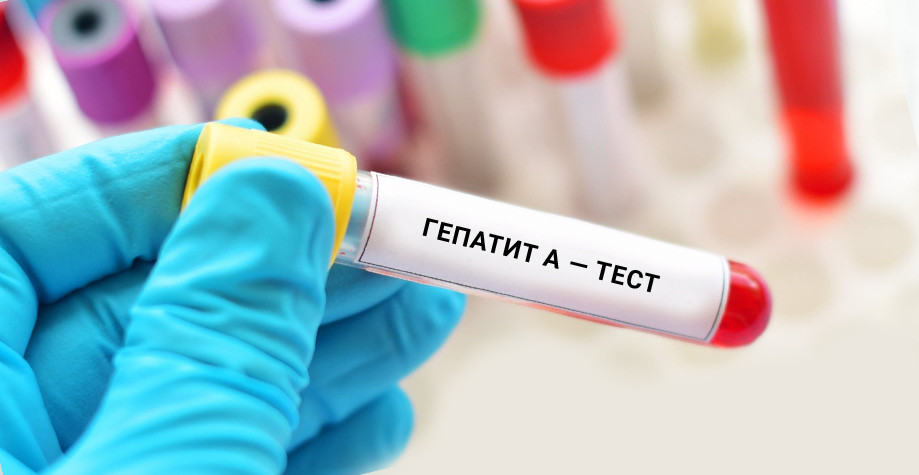 Київ охопила хвиля гепатиту А – закривають школи та перевіряють воду
