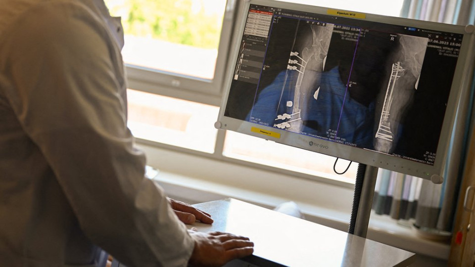 Омбудсман зафіксував різке зростання скарг на роботу медико-соціальної експертизи: у МОЗ пояснили причини затримок